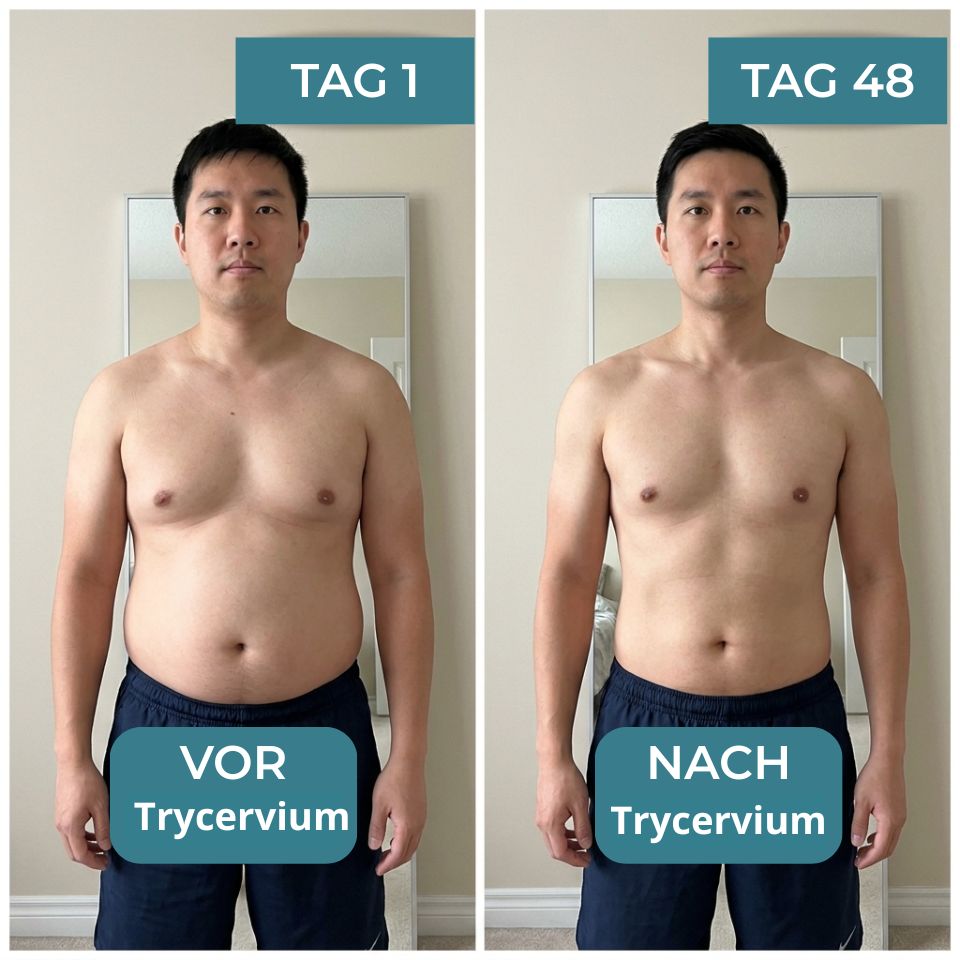 Trycervium™ | Figurformendes Kompressions-Unterhemd