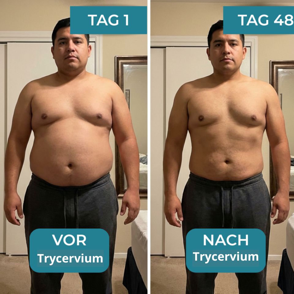 Trycervium™ | Figurformendes Kompressions-Unterhemd