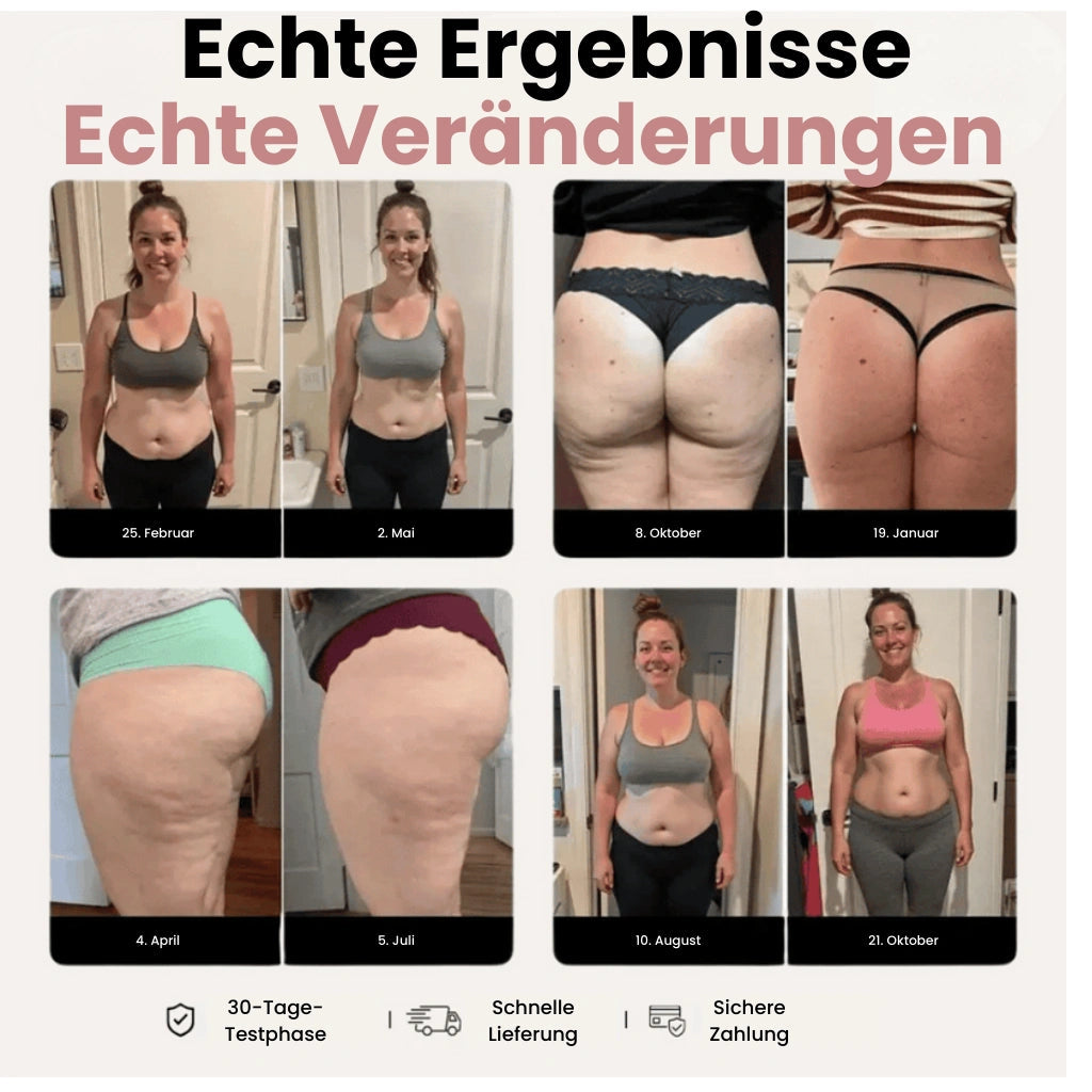 Trycervium 3D Leggings – Definieren Sie Ihre Silhouette mühelos neu.