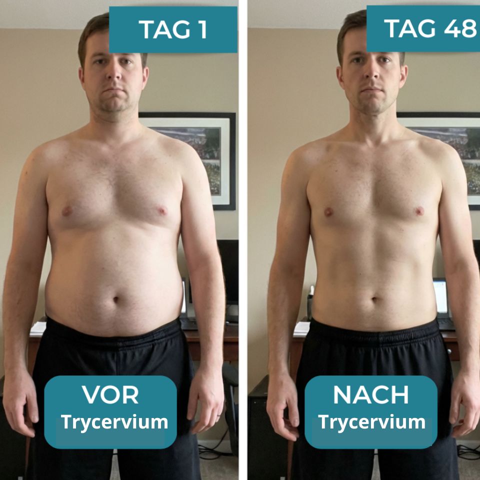 Trycervium™ | Figurformendes Kompressions-Unterhemd